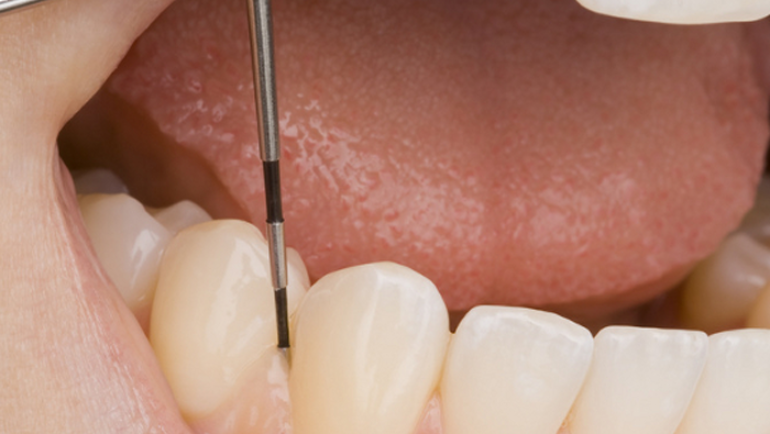 Periodontologia