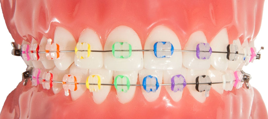 brackets.jpg